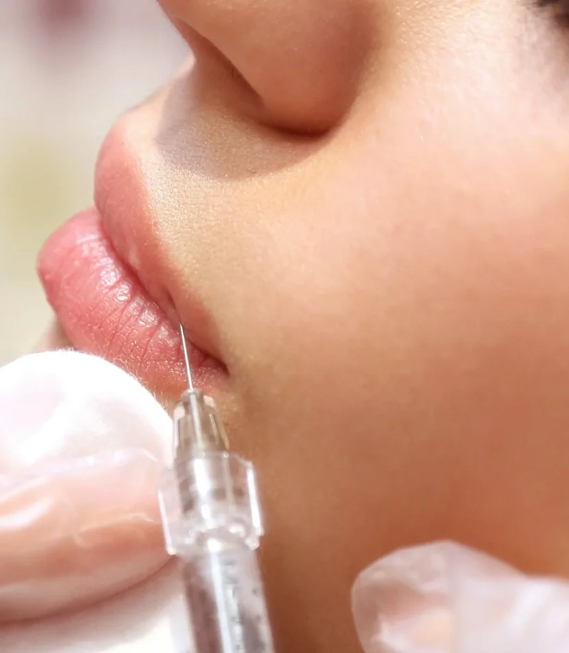 What is the Difference Between Botox and Dysport