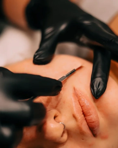Dermaplaning