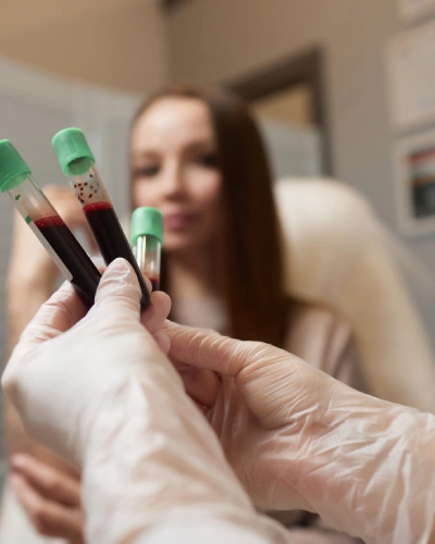 PRP THERAPY
