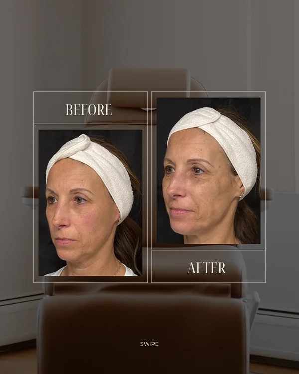 Facial Rebalancing 1