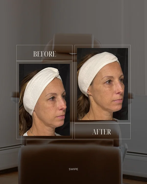 Facial Rebalancing_ 1