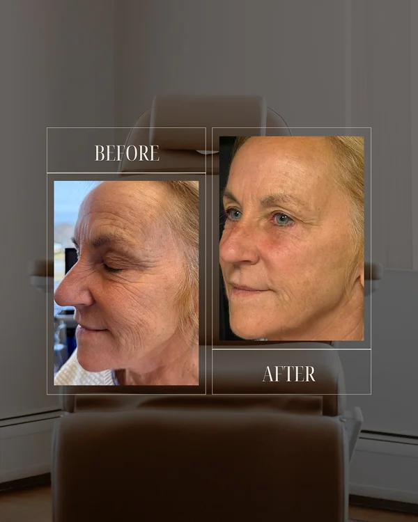 Full Facial Rebalancing 1