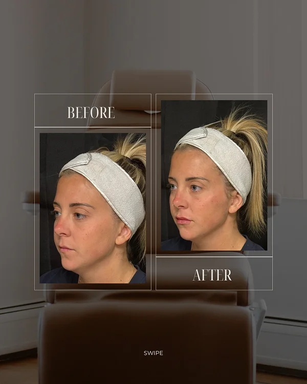 Full Facial Rebalancing(1) 1