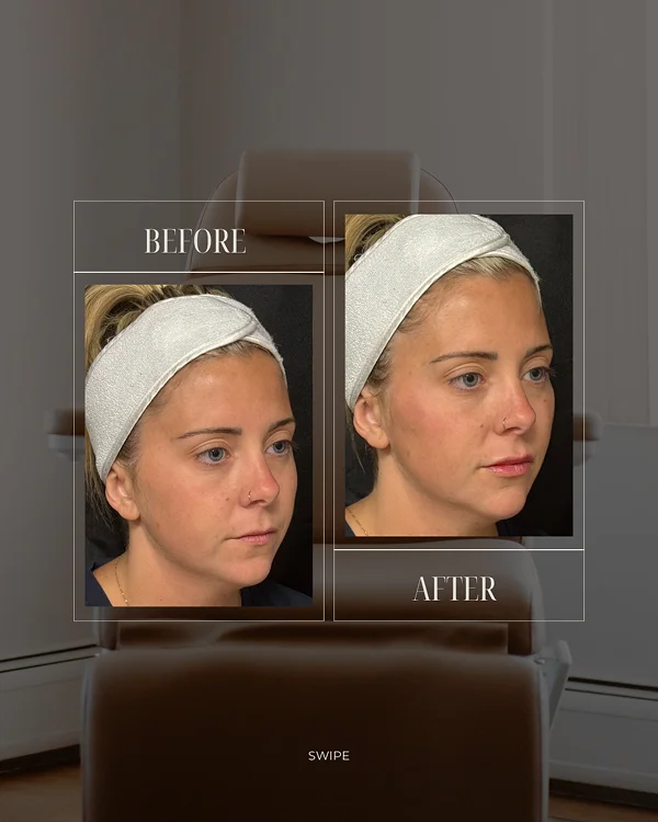 Full Facial Rebalancing(2) 1
