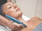 Cryotherapy for a Flawless You