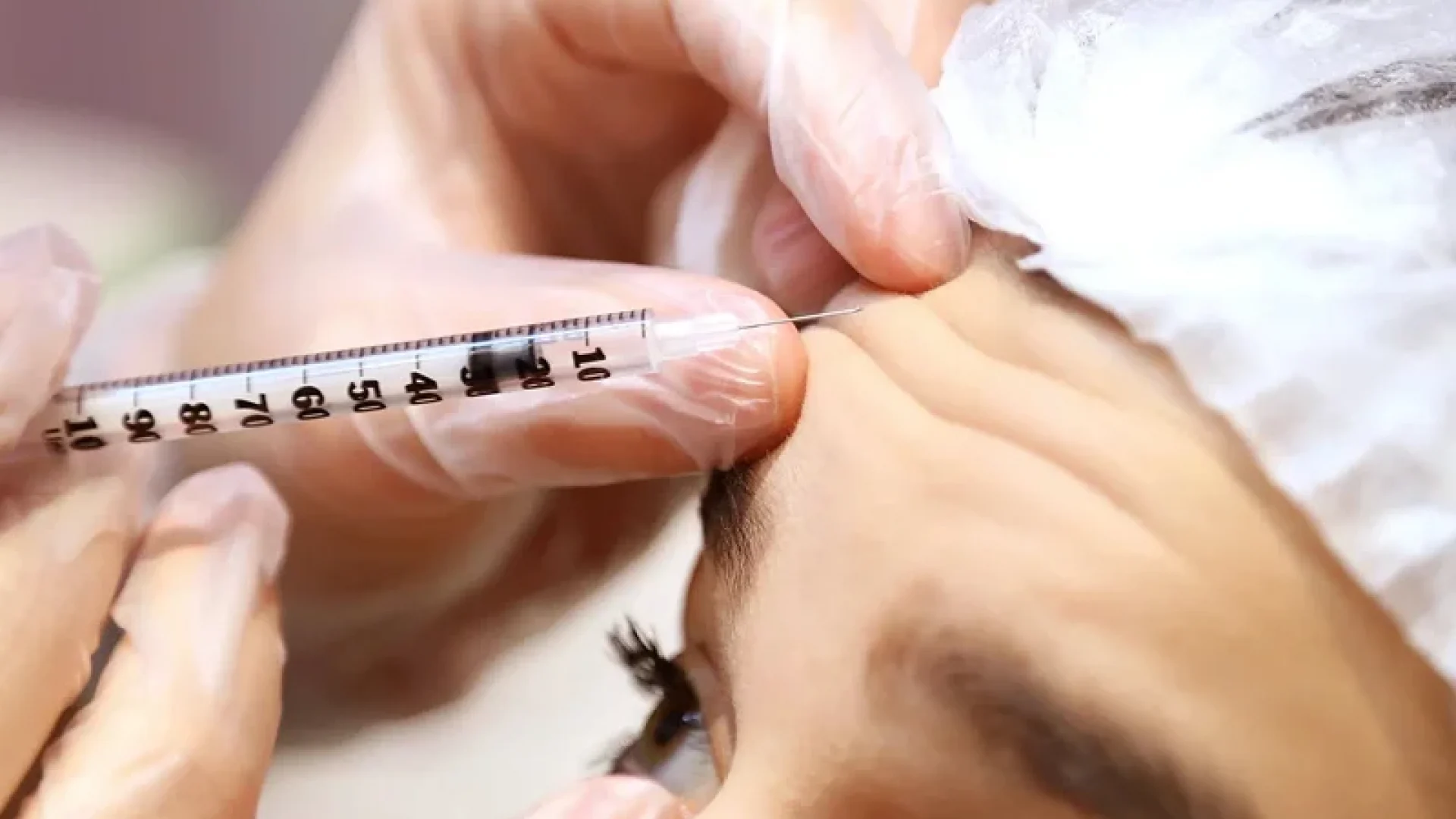 How Much Does Botox Cost_